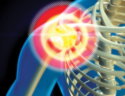 In 30-Minutes I Had a Plan for My Shoulder Pain that Didn’t Require Surgery or Pills